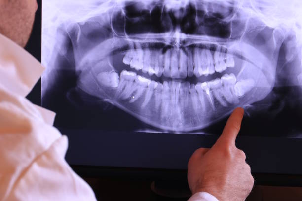 Best Cracked Tooth Emergency Dentist  in Atlantic City, NJ